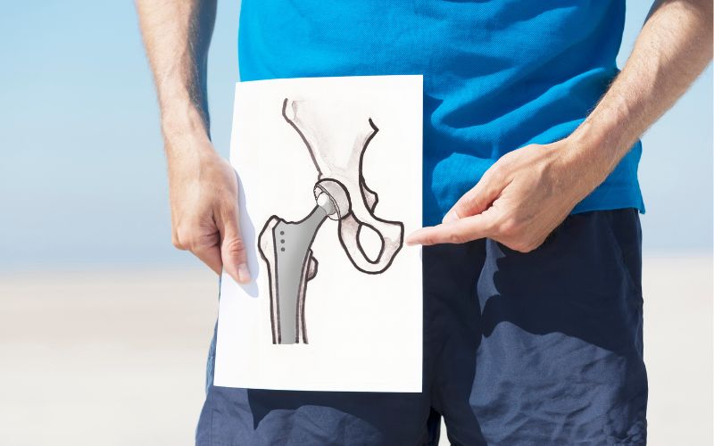 Hip Replacement